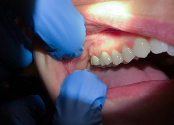 Best Emergency Dental Care for Sports Injuries in Watergate, FL