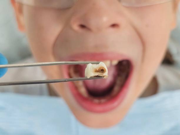 Best Emergency Care for Gum Disease in Watergate, FL